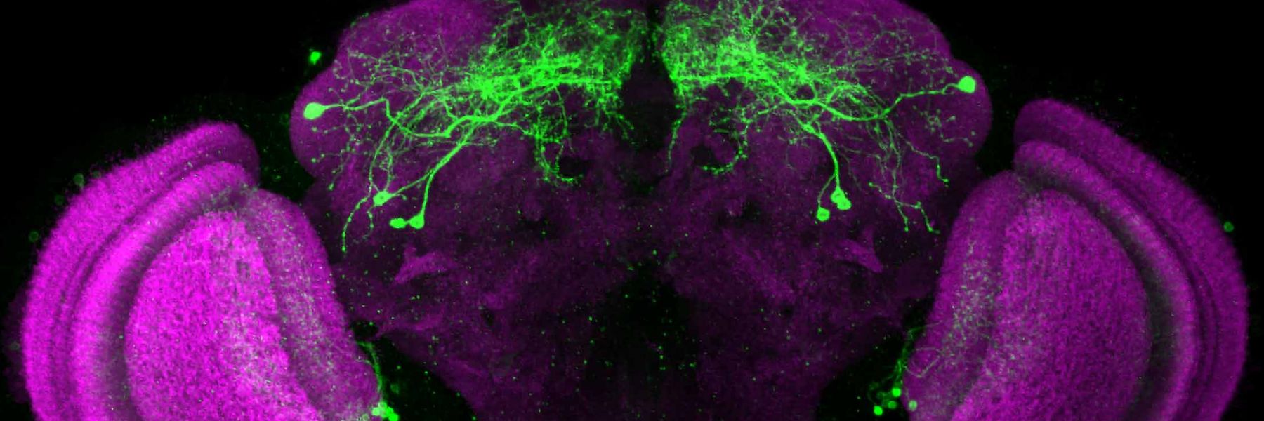 Cell Biology, Biochemistry &amp; Biophysics of the Nervous System. Credit: Craig Montell