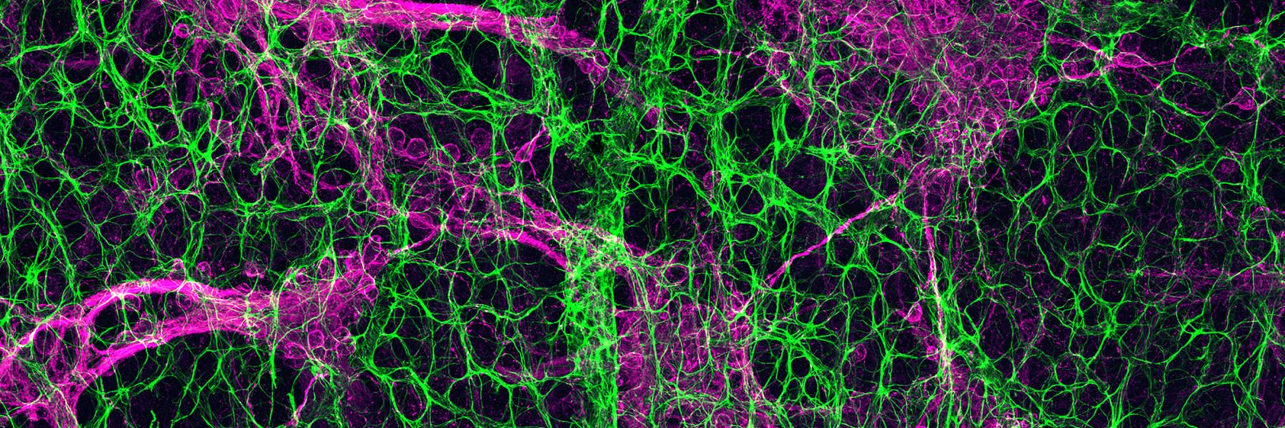 Tangle of Neurons. Credit: Patrick Keeley