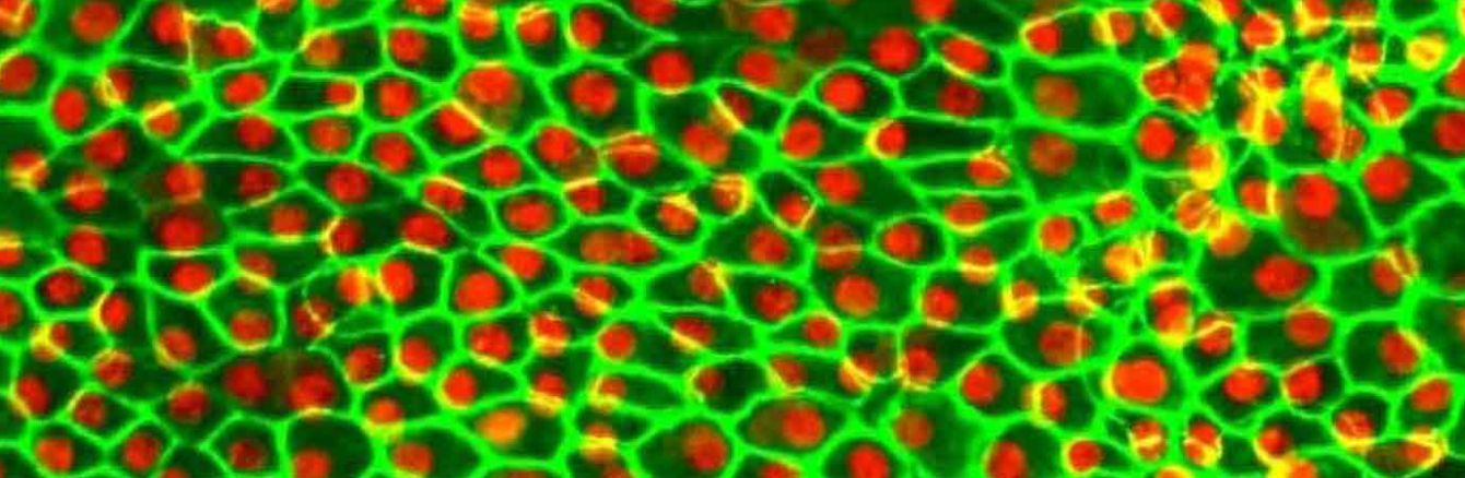 Stem cell-derived retinal pigmented epithelial cells. Credit: Dennis Clegg