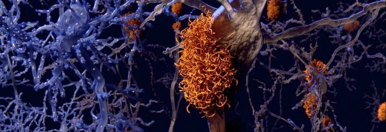 Tau Neuron. Credit: Kosik Lab