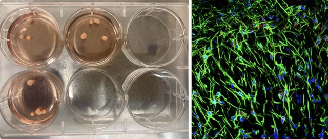 On the left, brain organoids float in a culture media that provides their needed nutrients. Each one is about the size of a grain of salt. On the right, an organoid has been cut and stained green to visualize a type of brain cell called an astrocyte. These abundant brain cells provide critical support for neurons to function, including the maintenance of their synaptic connectivity.