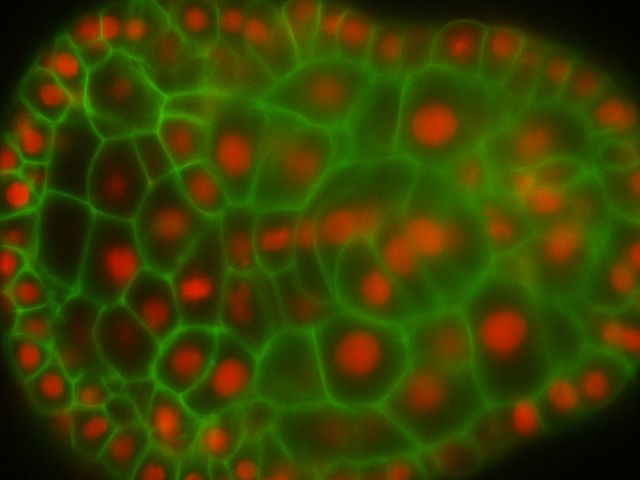 Development of the Nervous System